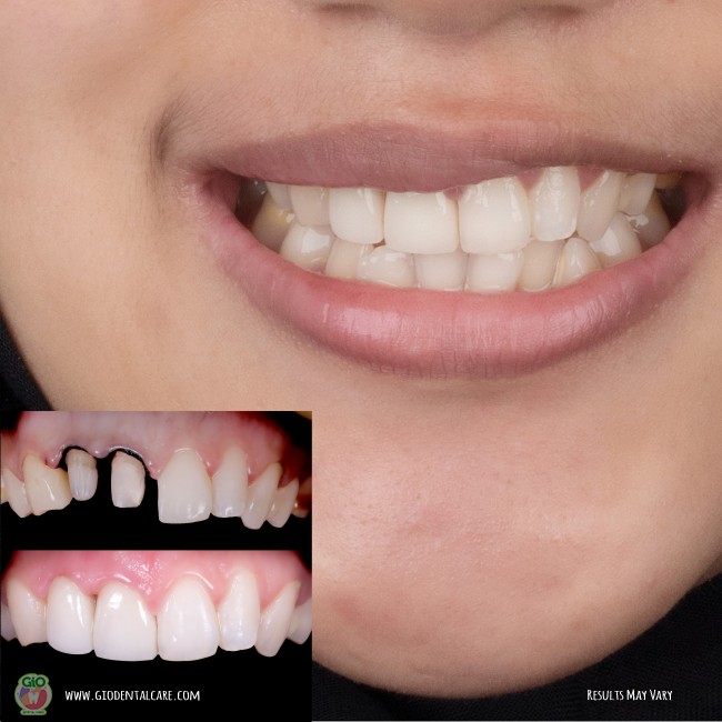 get-your-smile-here--1